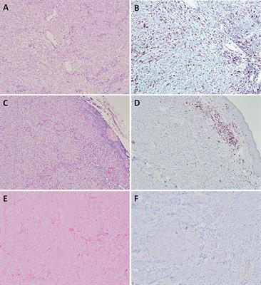 Cancer-Immunity Cycle and Therapeutic Interventions- Opportunities for Including Pet Dogs With Cancer